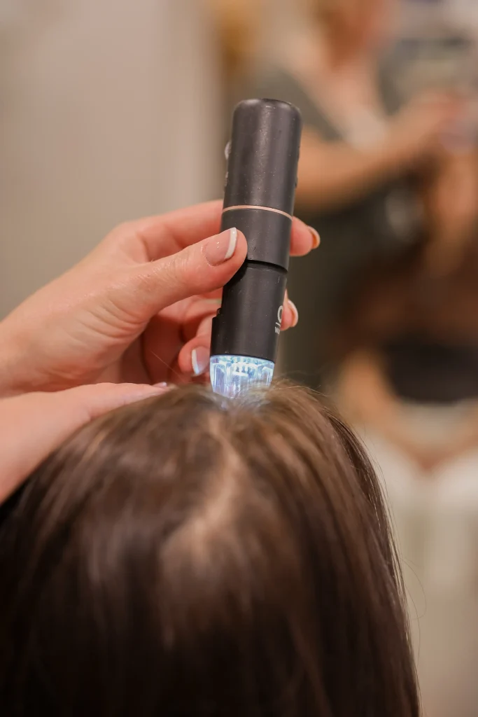 Verzorgende hoofdhuidbehandeling met een specialistisch apparaat bij Nature Hair Experience